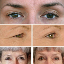 Load image into Gallery viewer, Augnlyfting